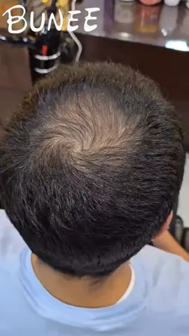 🔥From Thin to Full – Instantly! Your look matters — and we’ve got the instant fix! With BUNEE Hair Concealer Cream, enjoy a full, flawless finish that keeps your hair and beard looking perfect all day long. ✨ Why You’ll Love It: ✅ Works on hair, beard, and eyebrows ✅ Sweat-proof & rain-proof ✅ Easy to blend for a natural result ✅ Long-lasting coverage 🎁 Offer: Buy 2, Get 1 FREE + Free Shipping https://hairbunee.com/products/hair-concealer-cream #BUNEE #Hairbunee #HairConcealerCream #hairloss #fullerhair 