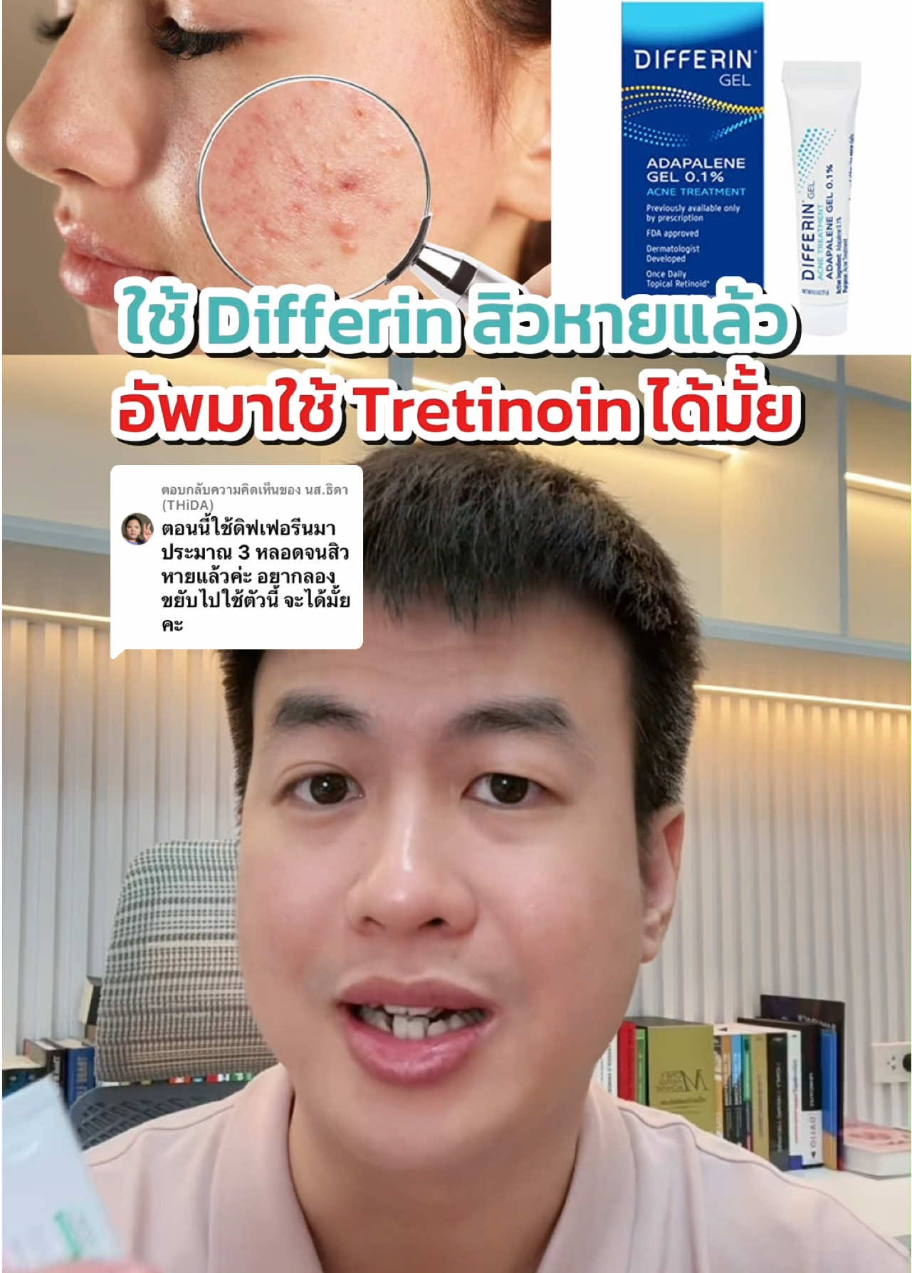 ตอบกลับ @นส.ธิดา (THiDA)  ใช้ Differin จนสิวหายขยับไปใช้ Tretinoin ได้มั้ย⁉️ #drname #หมอเนมคลินิกสุขภาพออนไลน์ #ครีมหมอเนม #สกินแคร์ #สกินแคร์ 