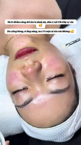 Còn 3 tháng nữa đến tết rồi ...#kwanbeautyrelax #xuhuong #chamsocda #dieutrimun #kwanspa 