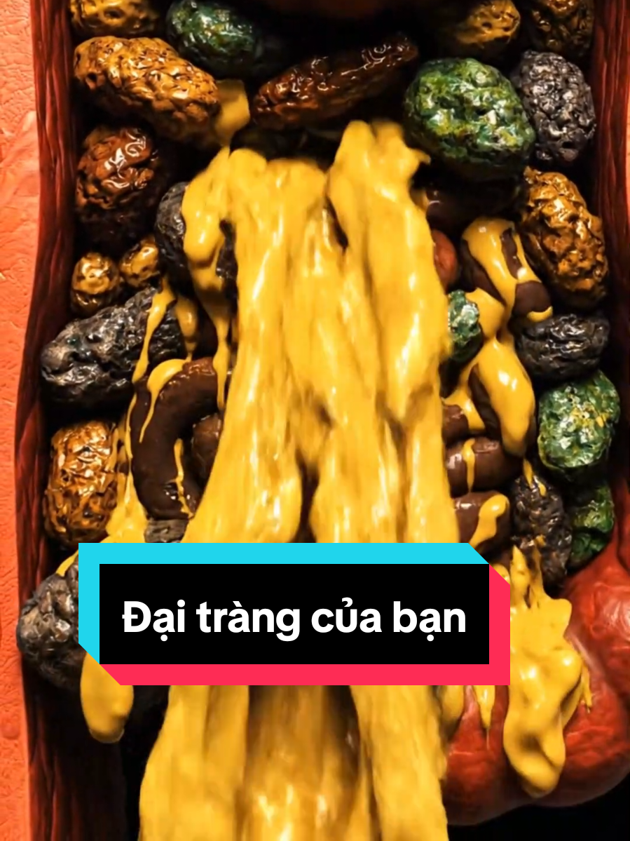 Chất thải 3 tuần trước có thể VẪN CÒN trong ruột bạn! 😱 Đây chính là lý do gây mụn, hôi miệng, chướng bụng. Giải pháp hỗ trợ cân bằng đường ruột ở đây! #suckhoe #LearnOnTikTok #thaidoc #daitrang #taobon   