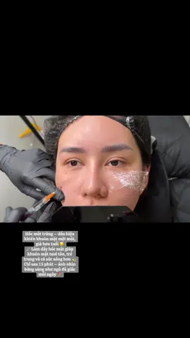 ✨ LÀM ĐẦY HỐC MẮT – “CHỮA LƯỜI NGỦ” CHO KHUÔN MẶT ✨ Không cần makeup che khuyết điểm, đôi mắt vẫn đầy đặn – long lanh tự nhiên 💉 Mềm – mịn – tươi sáng, nhìn là thấy “trẻ lại 5 tuổi” #beauty #xuhuong #pttm #fypシ #FillerAnToàn 