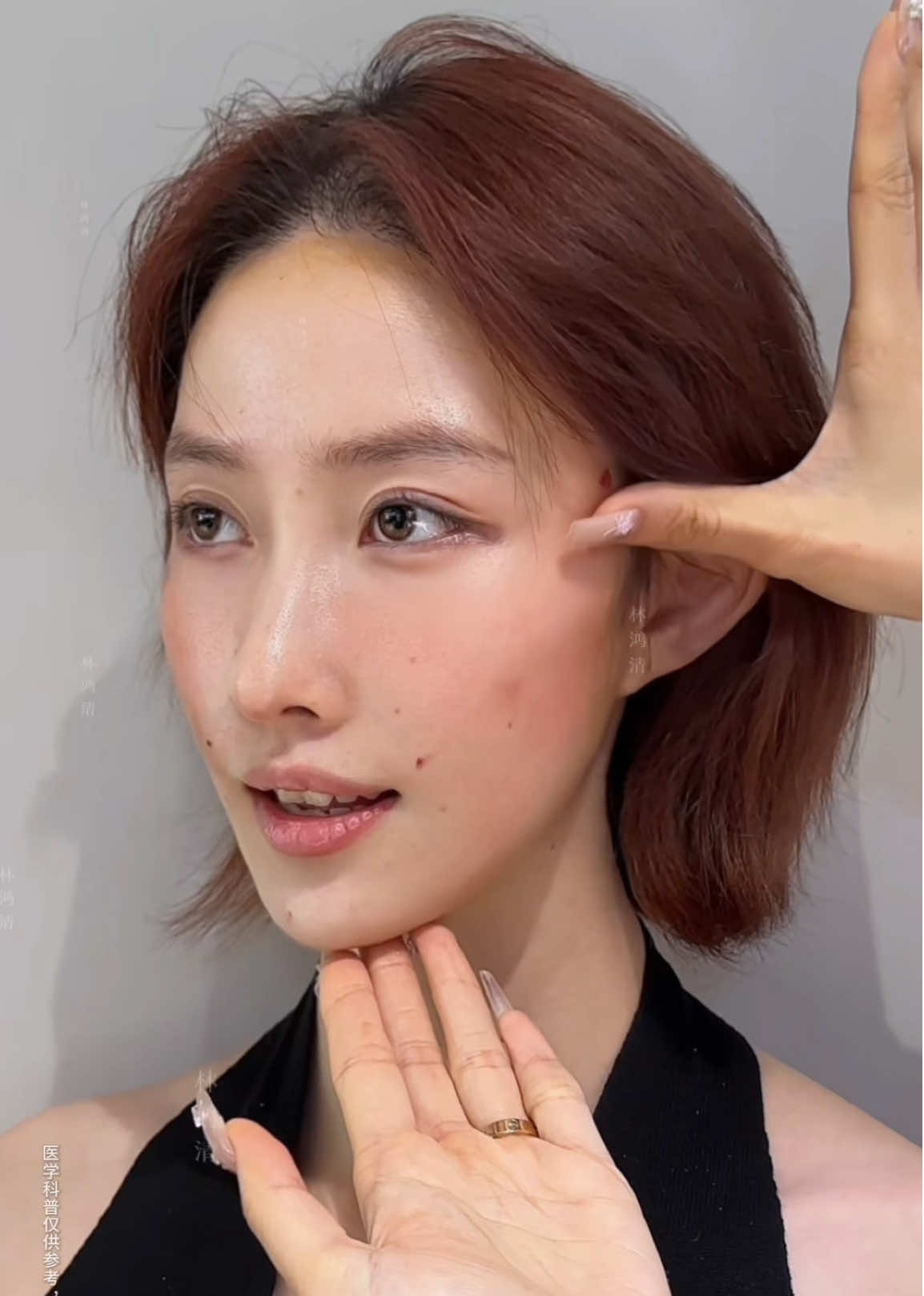 From Tired to Timeless 💫 Just 2 months after giving birth, this 35-year-old mom decided to do the 9D Lift — and the transformation was incredible. Her face became lighter, tighter, and full of energy again. Motherhood may change your life, but with 9D, you can still shine with your own beauty. #9DLift #FacialRejuvenation #PostpartumBeauty #MomGlow #YouthfulFace     