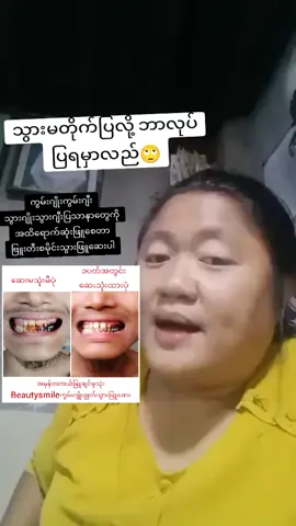 #ယုံကြည်စိတ်ချစွာမှာယူနိုင်ပါတယ်♥️ #ON4t #ကွမ်းဂျိုးသွားဂျိုးပျောက်ဆေး #မဖြူရင်ငွေပြန်အမ်းမယ်🔥 