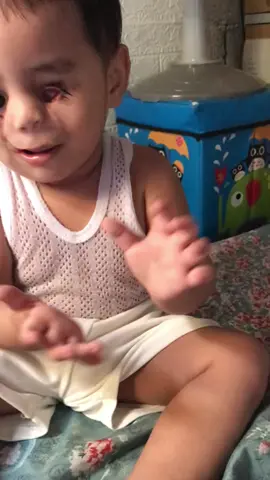 Potato 😅🤭#babymattmatt #fypシ゚ #cleftstrong #littlewarrior #cleftpalate 