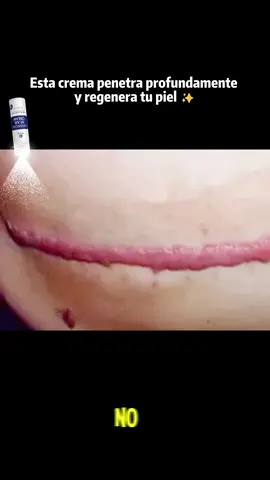 #fyp #usa #scar 