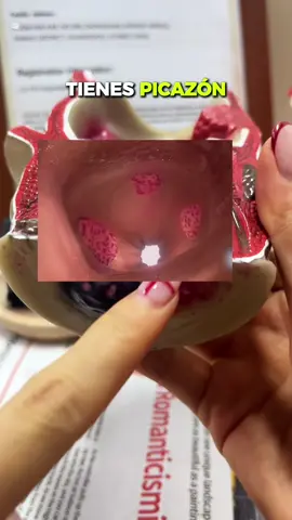 #hemoroid #painrelief #tiktokmademebuy #foryoupage #bodycareproducts 