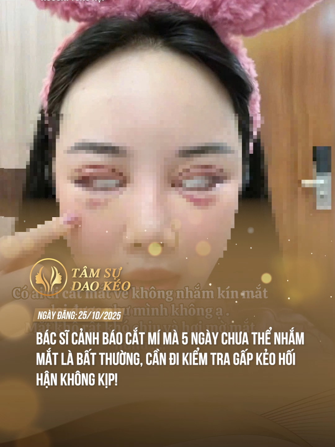 Cẩn thận không lại thành nhìn đời bằng nửa con mắt chị em nhé ! #tamsudaokeo #theanh28 #tiktoknews #thammy #fypツ