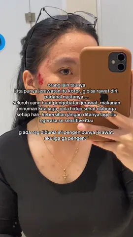 #acne #acnefighter 