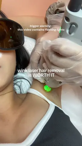 Replying to @Paola Lynn TW: flashing lights if you’ve been planning on getting laser hair removal, this is your sign to choose @Wink Laser Studio 💛 #winklaserstudio #laserhairremoval #hairremoval #highmaintenancetobelowmaintenance #beautyph