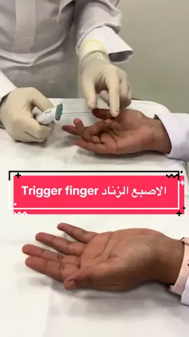 #الأشعه_التداخلية_لعلاج_المفاصل_والظهر #أ_د_نزار_عبدالعزيز_النقشبندي #الاصبع_الزنادي #fyp #الرياض_جده_مكه_الدمام_المدينه 