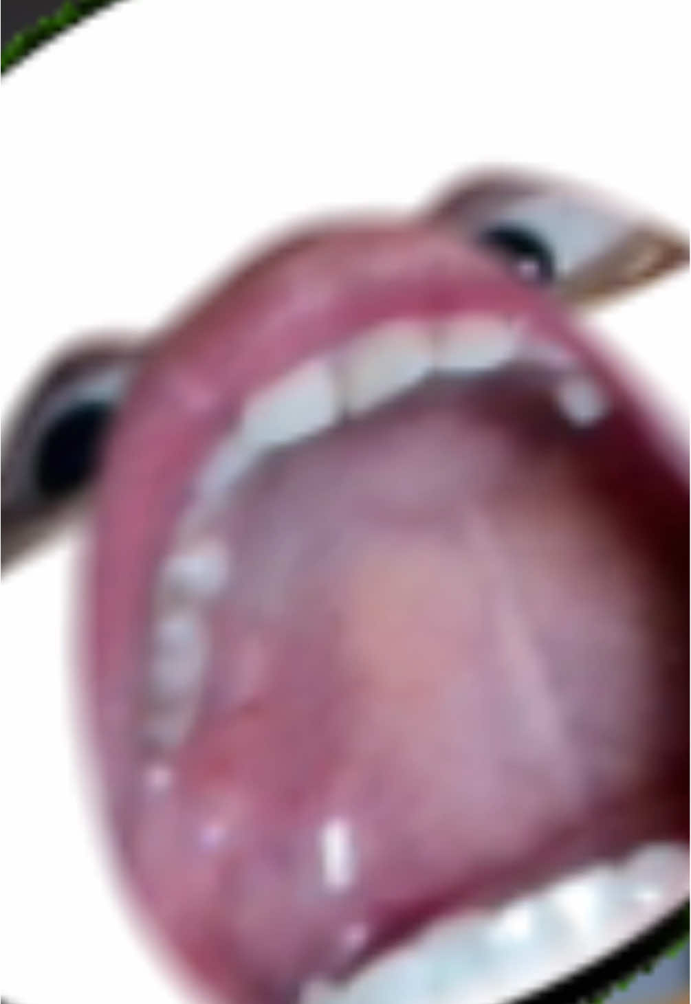 【君ら指の力強すぎ】#リズムに合わせて #ネタ #面白い #shorts