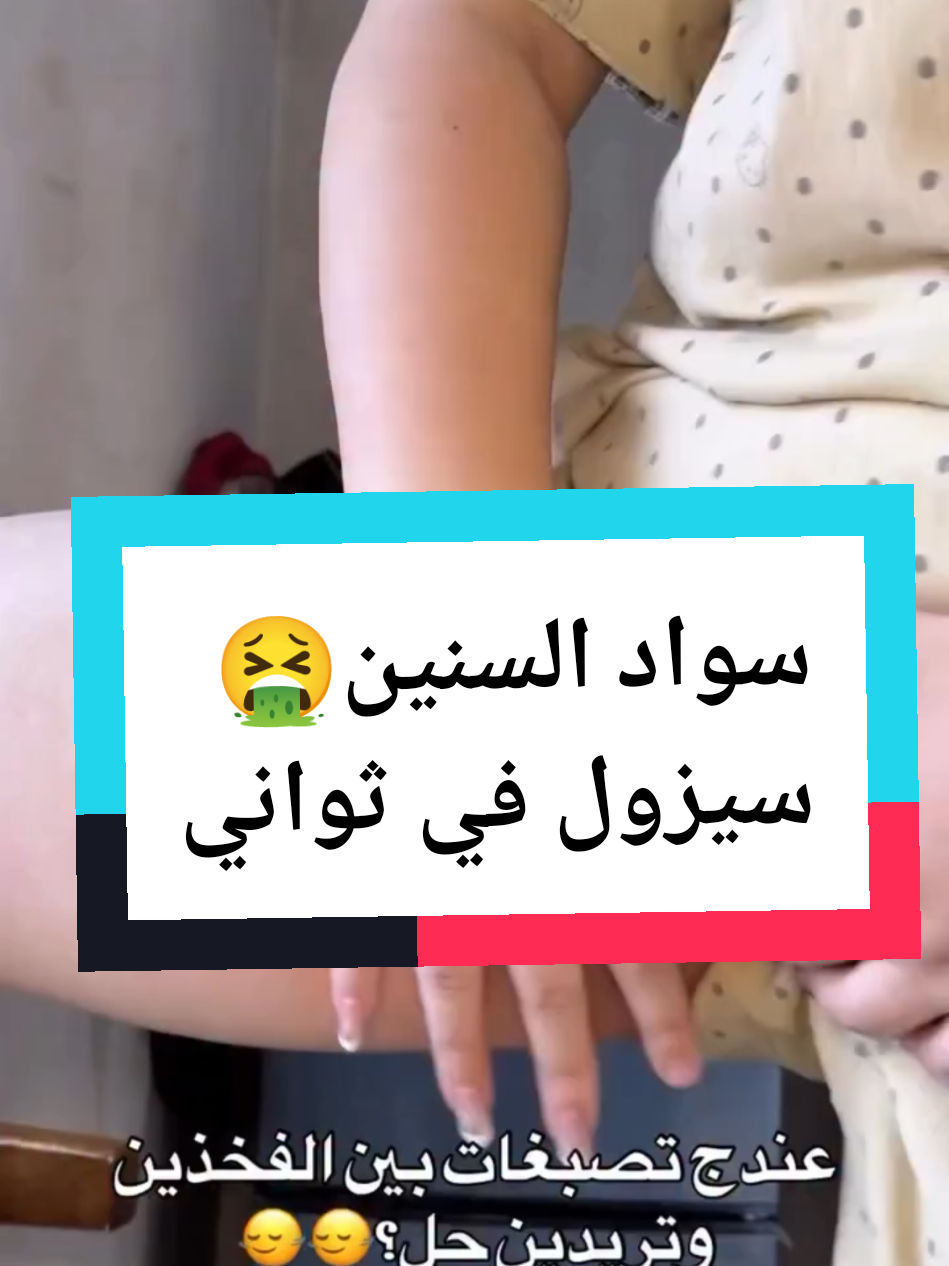 وداعا التصبغات و السواد و مرحبا و هلا بالبياض و النعومة✨🌸 #اكسبلور #fyp #تصبغات #سوادـالجسم #تبييض 