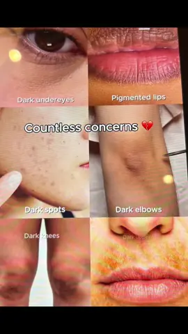 @KSECRET GLOBAL #KSECRETGlowChallenge #KSECRET #seoul1988 #darkspots #hyperpigmentation