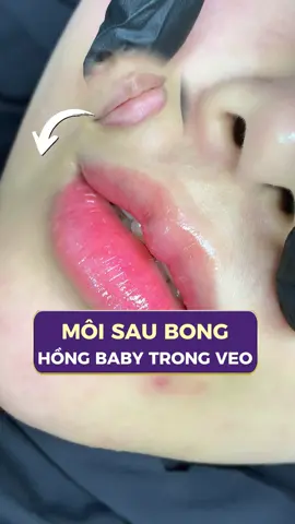 Môi sau bong HỒNG BABY TRONG TRẺO - TỰ NHIÊN. Đăng ký cấy môi Diamond Lips giảm ngay 2/3 giá gốc. Đặt lịch liền hôm nay #tmvlinhanh #thammylinhanh #phunmoi #phunmoitunhien #caymoidiamondlips 