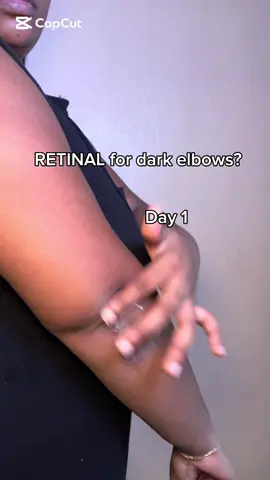 Dark elbows  Anti-aging, Brightening, Pore Care, Texture Improvement @KSECRET GLOBAL  #KSECRETGlowChallenge #KSECRET #Seoul1988 #retinal #CapCut 