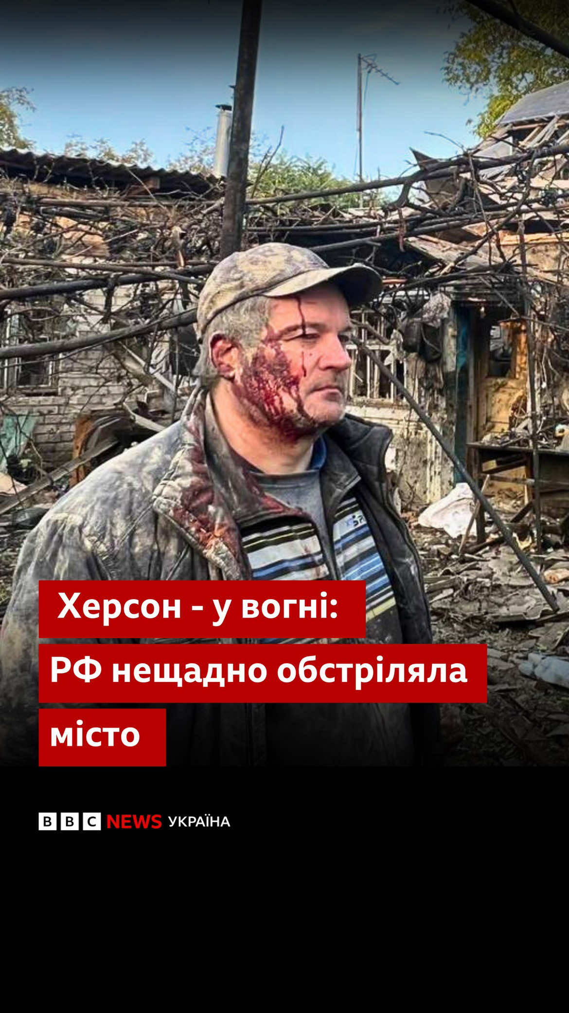 Житлові райони Херсона нещадно обстрілюють російські війська. Від ранку 24 жовтня відомо про двох загиблих та понад два десятки поранених. #херсон #обстріли #війна #корабельнийрайон #bbcnewsukrainian 