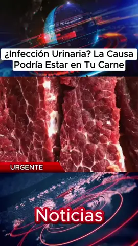 ¿Infección Urinaria? La Causa Podría Estar en Tu Carne
 #InfecciónUrinaria #Carne #Salud #usa#eeuu
