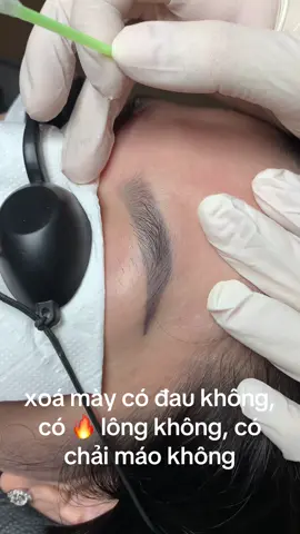 tháng e ra phải mấy chục lip xoá mà vẫn con khách hỏi 😆😆😆#xoaxamdanang #xoamaydanang #laserdanang #phunxamdanang 
