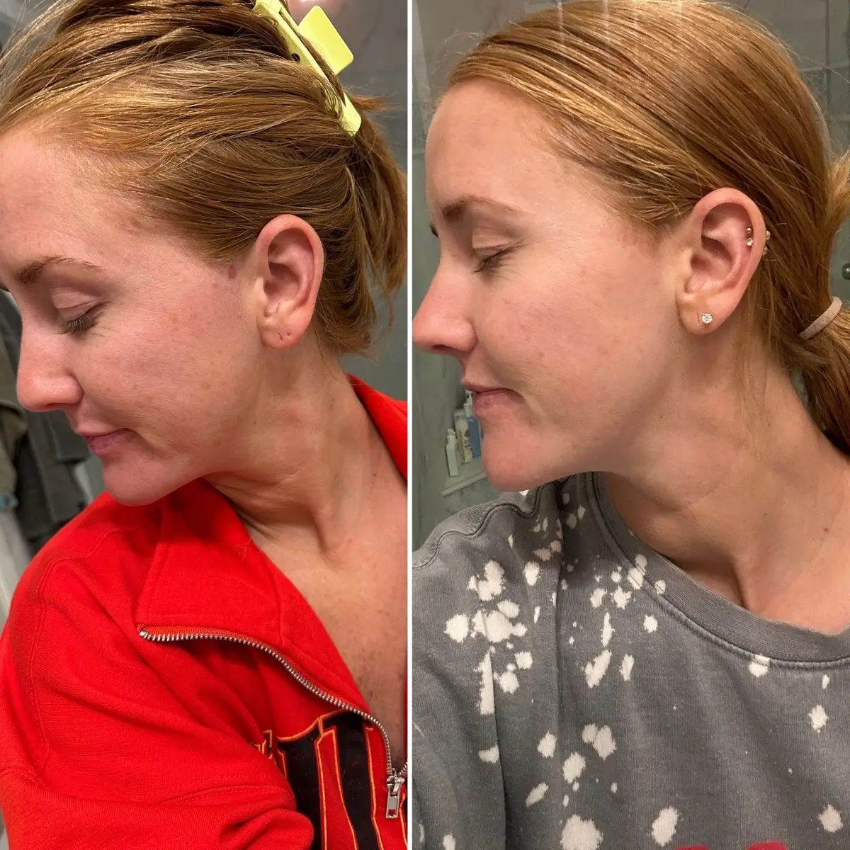 I honestly wasn’t expecting to see this good of results in 6 weeks from JUST the bar of soap but yall im blown away. My dark spots are slowly fading, fine lines and wrinkles noticeably better, acne as been pretty good minus one tiny pimple on my chin in all 6 weeks which was mostly a reflection of my sugar intake…I’m so impressed!! Linked in my showcase!! @Organic Herbal Face Food #herbalfacefood #acne #wrinkles #darkspots 