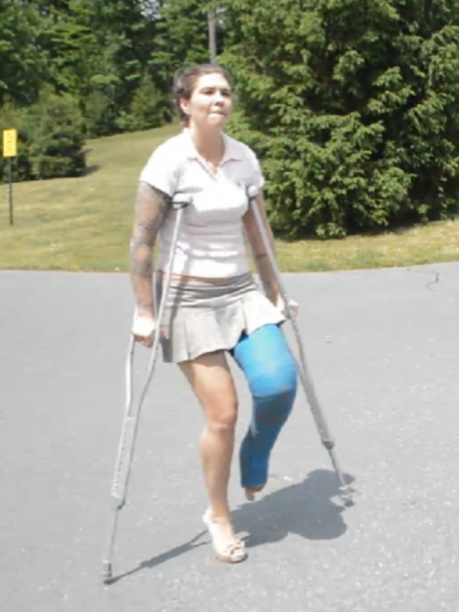 Do you like casts ? 🥰 #llc #crutches 
