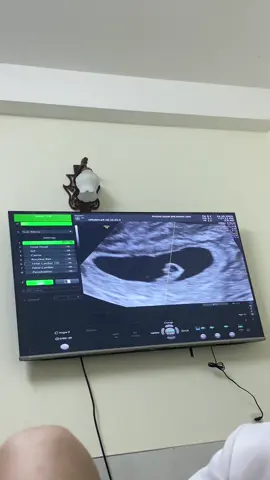 Nay ra máu hồng nên đi khám, nay có tim thai rồi bám thật chặt vào mẹ em nhé 🥰🥰🥰 #mevaembe❤️❤️❤️  #embe #6w4d 