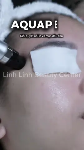 💎 Sau liệu trình Aqua Peeling – làn da bạn sẽ “thở” được, mềm mịn và sáng hơn trông thấy 💫 #mesocantho #chamsocdacantho #phunxamthammycantho 