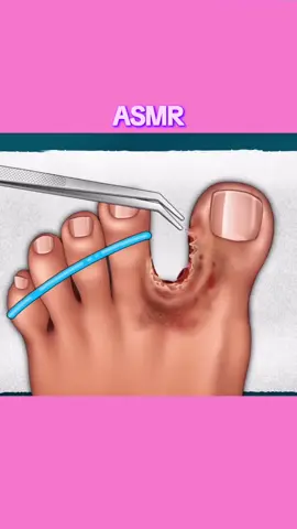 Subscribe Here - @pkr_sshow #asmr #relaxingasmr #asmrtreatment #tiktok #fyp 