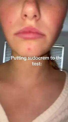 Better than expected #sudocrem #goviral #moots? #fypp #foryoupage 