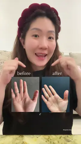 Kulit sensitive cobain produk ini #wundplus #wund #margaretawijaya #gwswellness #fyp 