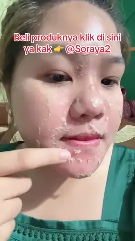 BELI PRODUK DAN KERANJANG KUNINGNYA KLIK DI SINI YA 👉 @Soraya2 