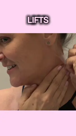 Such a gorgeous neck transformation ✨ so natural, so comfortable 🤩 #NeckLift #NeckTransformation #instantlift #BeforeAndAfter #ConfidenceGlow