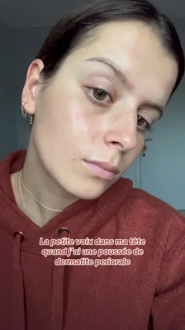 J vous jure ça change tout punaise  #dermatiteperioral #dermatitis #perioraledermatitis #skinproblems 