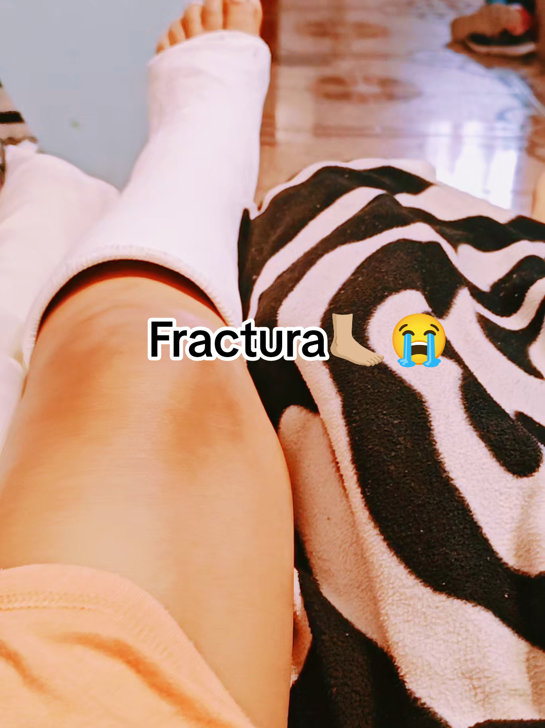 🥺🥺A cortarme la mala pata🦶🏼 #fractura #yeso #recuperacion #tristerealidad #auxilio 