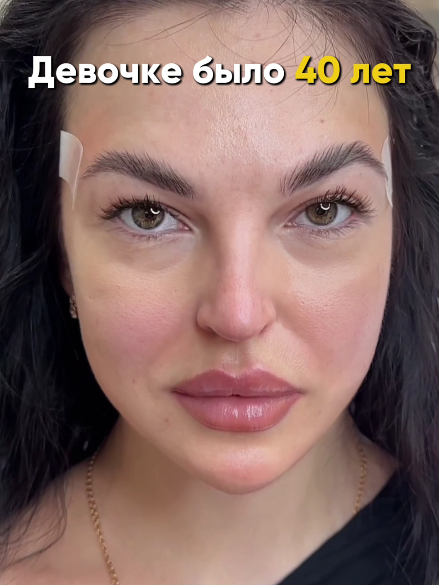 🌿FULL FACE - естественности🌿 Помогли преобразиться нашей пациентке🔥 Убрали уставший вид и проработали с качеством кожи😳 🧨Проводили процедуру full face для пациентки 🫶🏻Ваша реакция после процедуры говорит сама за себя  🫶🏻Мы стараемся выкладываться на максимум  Используем премиум препараты  И постоянно повышаем квалификацию🔥 Записывайся и получи скидку 👉😁#натуральнаякрасота #естественнаякрасота #косметология #fullface 