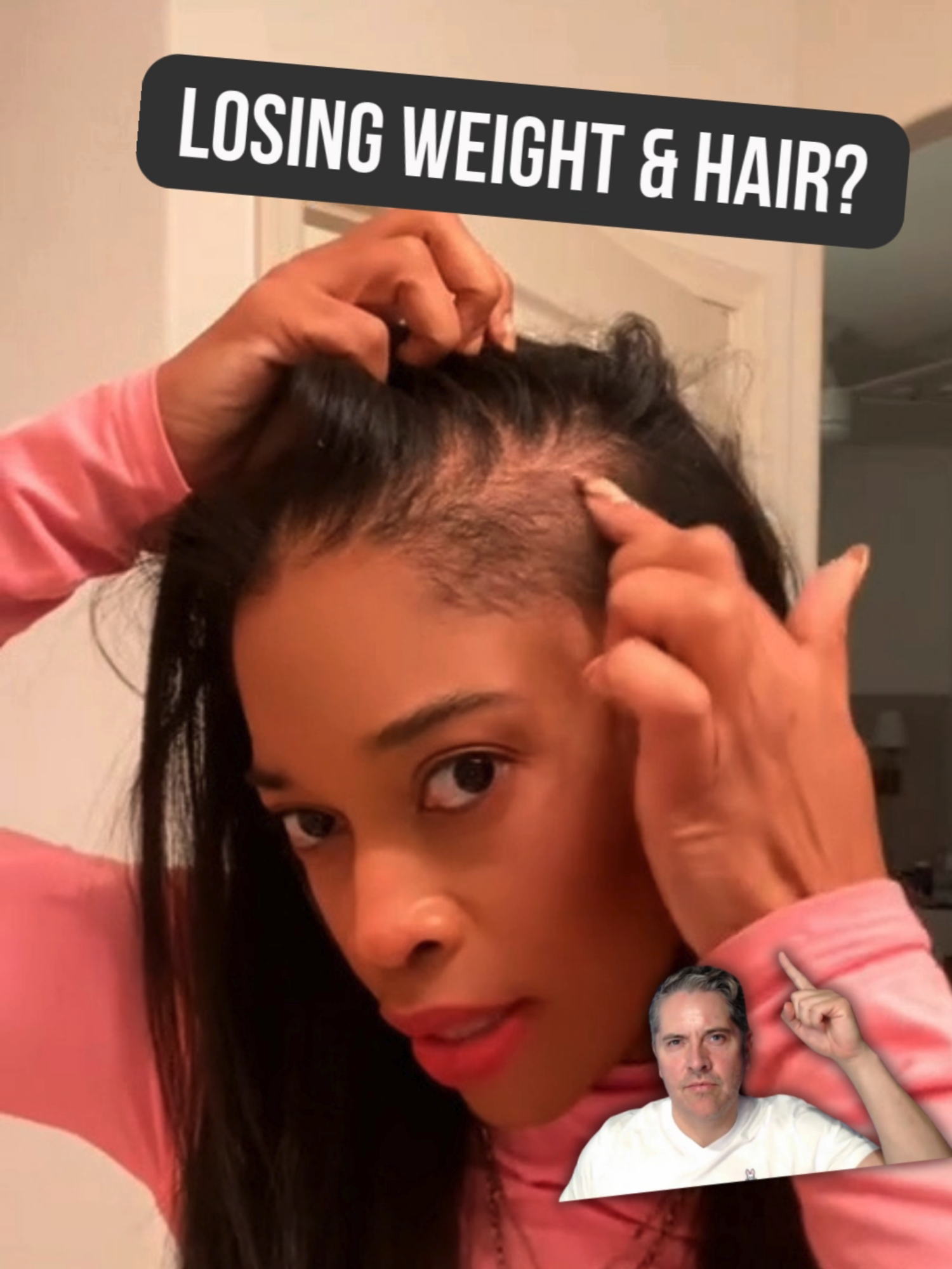 💊 Did you know some weight loss medications can affect your hair, nails, and bones? People using GLP-1 drugs like #Ozempic or #Wegovy often notice hair loss, fragile nails, or bone discomfort. It’s not always the medication. When appetite drops, we eat less protein and nutrients, which can impact overall health. ✨ The good news: With proper nutrition, protein intake, and follow-up care after weight loss or bariatric surgery in Mexico, these effects can be prevented and reversed. 🇲🇽 Mexico is a top destination for medical tourism, offering safe, affordable, and high-quality bariatric procedures with excellent recovery support. #MedicalTourism #BariatricSurgery #Mexico #WeightLossJourney #GLP1 #Ozempic #Wegovy #Semaglutide #HealthyWeight #Nutrition #Wellness #MetabolicHealth #TravelForHealth #GlobalHealth #SafeSurgery