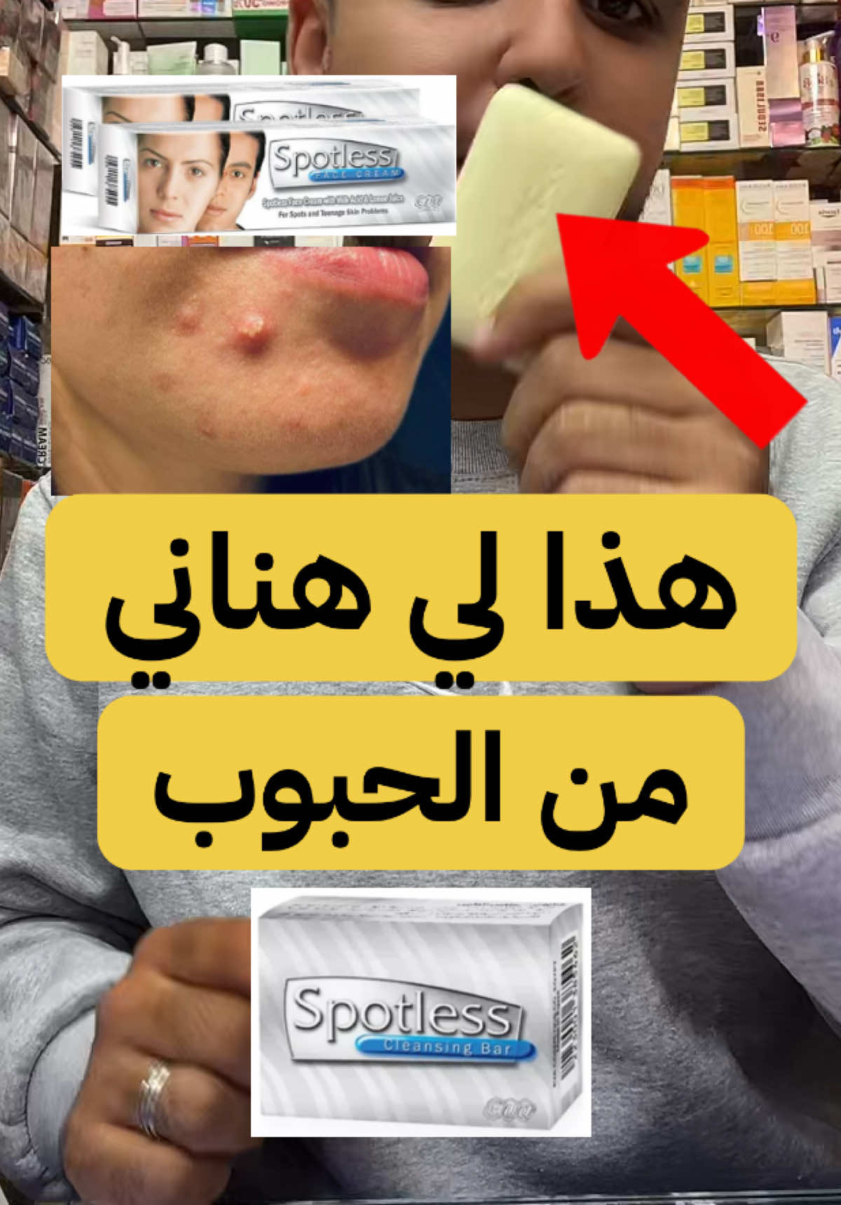 acne skincare routine A basic acne skincare routine involves gentle cleansing twice a day, using targeted treatments like salicylic acid or benzoyl peroxide Acne treatment  #acne #acnetreatment #skincare 