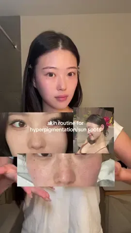 my freckles act so difficult w me ugh @skinnlab  #gluthatione #vitaminc #darkspottreatment #glassskin #skinnlabpartner 