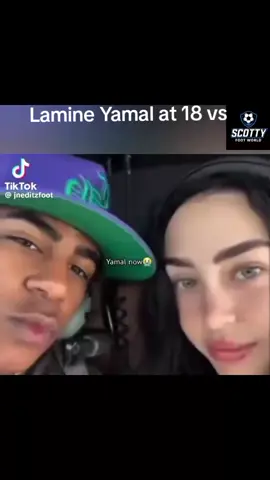 Mbappé edit/Parti 1:VS Yamal. #mbappe #yamalnickinicole #prime #football #halamadrid Madrid 