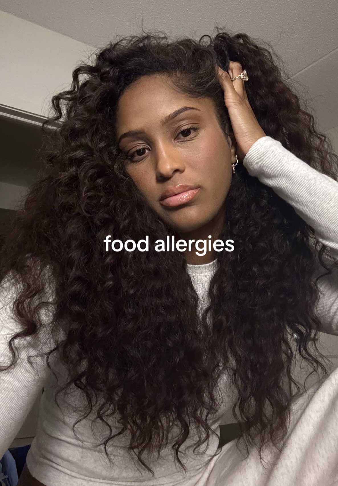 PSA: don’t invite me out to eat NO MORE!! #eczema #eczemaawareness #dryskin 