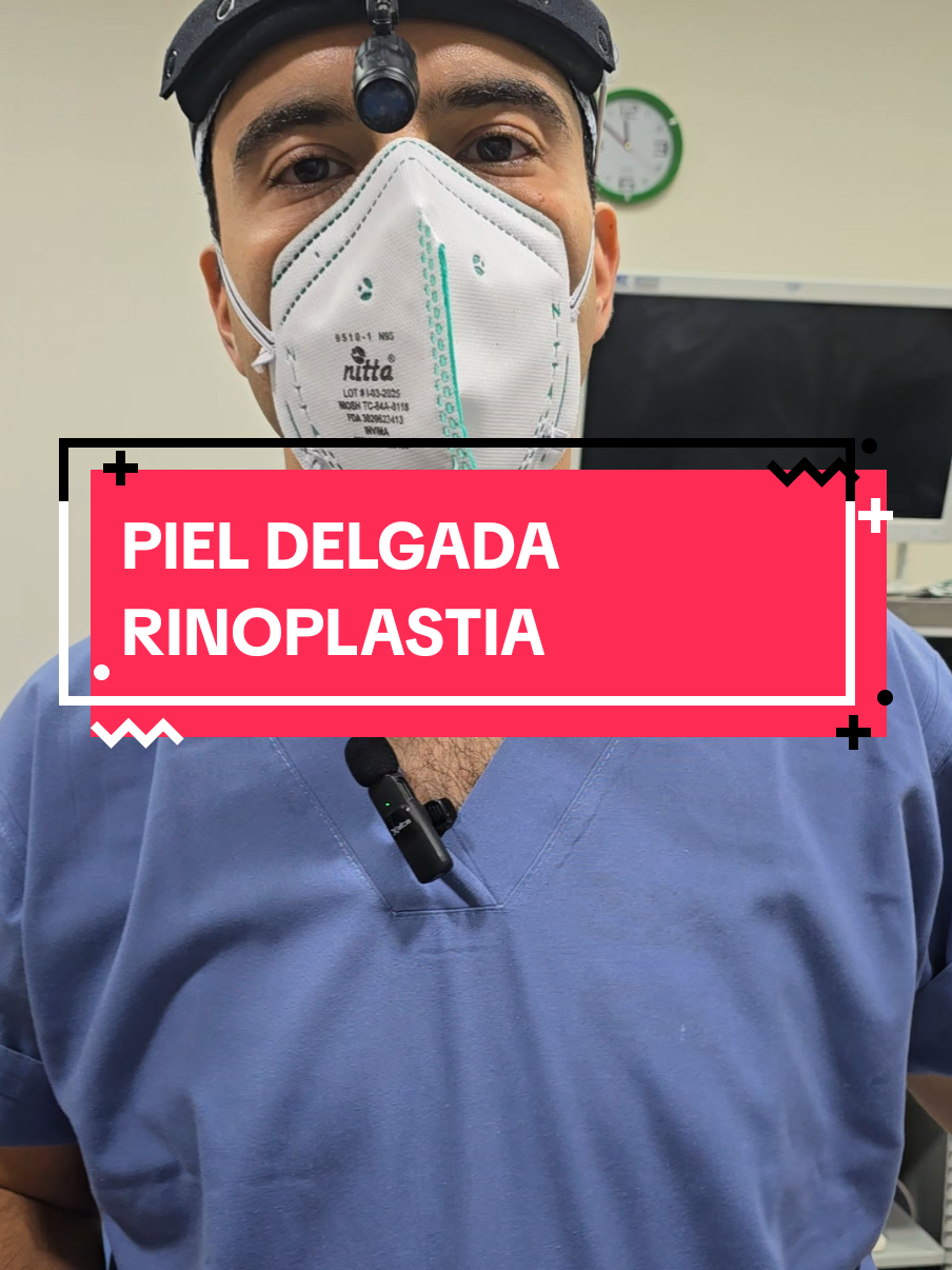 PIEL DELGADA EN RINOPLASTIA  Si estas por fuera de Colombia puedes realizar una valoración virtual,  agendar tu Cirugía de Nariz y estar con nosotros durante 15 días, regresando a casa para continuar con controles virtuales  Recuerda que todos estos cambios los podemos obtener gracias a nuestra consulta de rinoplastia donde realizamos: ✅Análisis facial detallado  ✅Evaluación endoscópica intranasal  ✅Examen físico nasal ✅Simulación nasal Agenda tu cita ya  ☎️ 302 418 2121 - 302 462 0063 #cirugiadenarizbucaramanga #rinoplastiabucaramanga #rinoplastiacolombia #rhinoplasty  #cirugiadenarizsintapones 