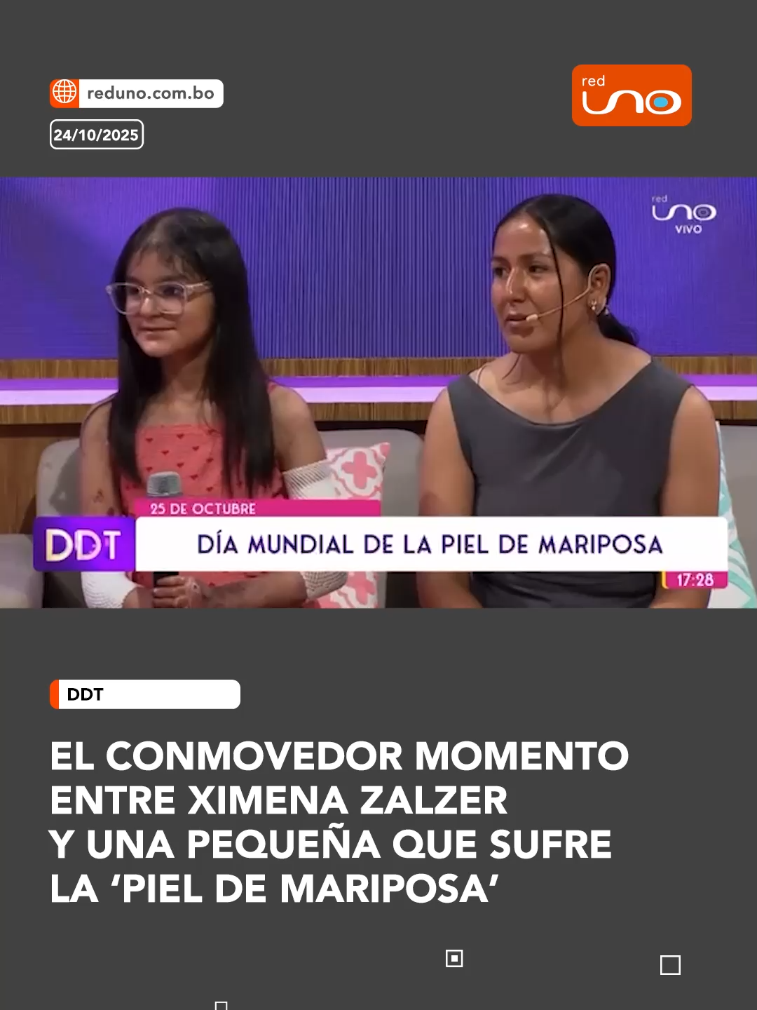 #DDT l Un conmovedor momento se vivió en el programa Dueños De la Tarde, entre nuestra presentadora Ximena Zalzer, y una pequeña que padece la enfermedad 'piel de mariposa', cuando la madre de la niña agradeció a Ximena y ésta rompió en llanto, sin duda, un momento para recordar. Visita reduno.com.bo #RedUno #Tierno #Momentos