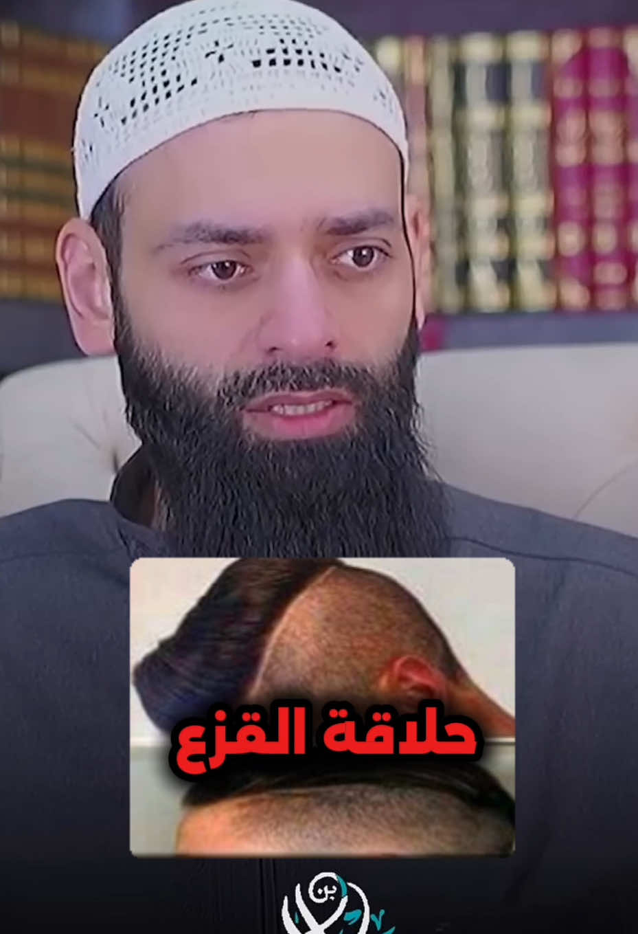 حلاقة القزع #محمد_بن_شمس_الدين 