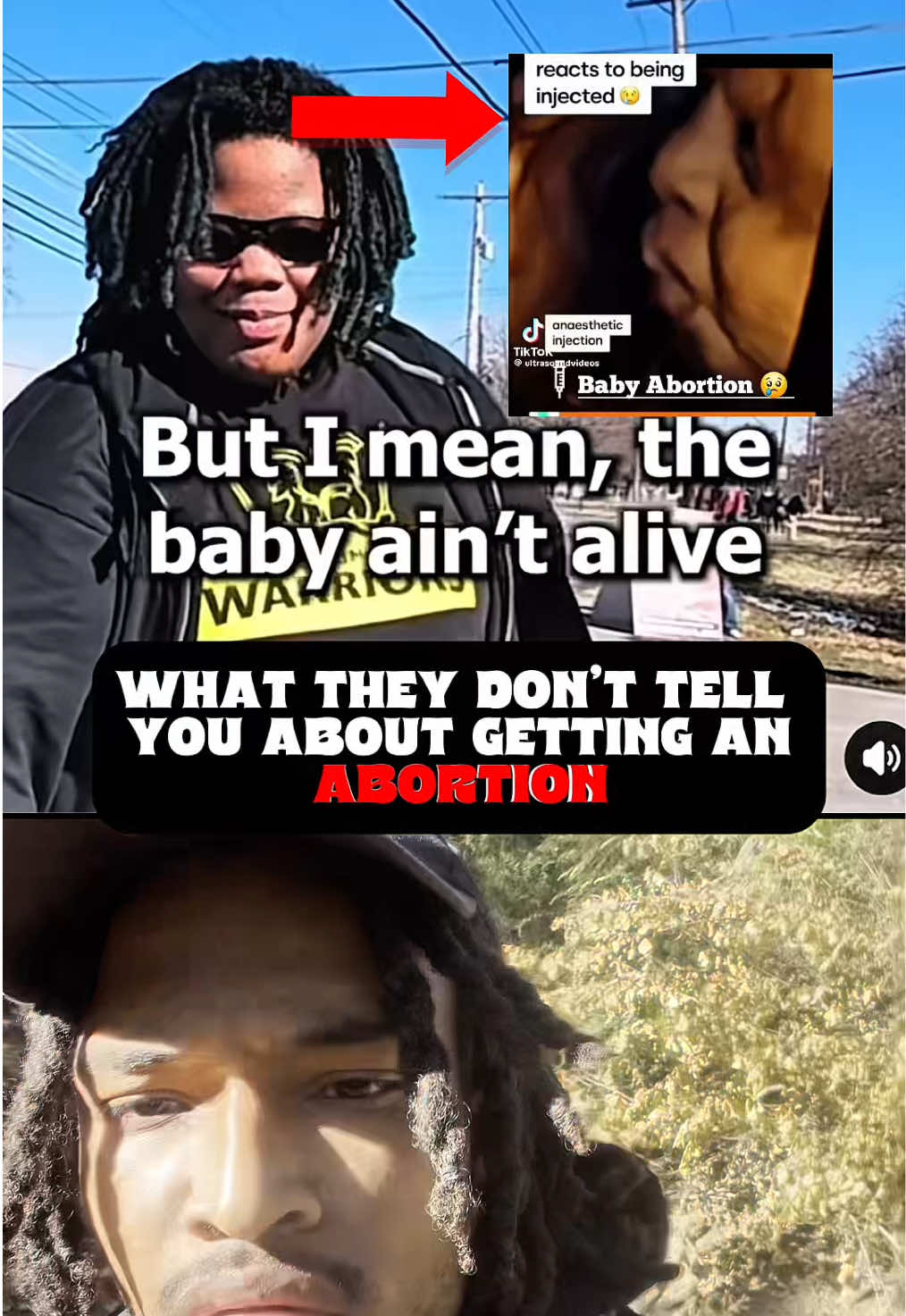 ⚠️Watch this before you get an abortion! God has a plan for every child in the womb we should not choose to abort them out of convenience or just in general! God will always make a way! Pray to him. Seek him! 👇  “But seek first the kingdom of God and His righteousness, and all these things shall be added to you. Therefore do not worry about tomorrow, for tomorrow will worry about its own things. Sufficient for the day is its own trouble.” ‭‭Matthew‬ ‭6‬:‭33‬-‭34‬  #christianreels #abortion  #exposed #prolife #fypシ  