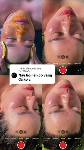 Trả lời @^~^Mẫn^•^  ko những ko vàng . Mà còn hồg đẹp #cốtnghệmẹSun #nhung_care 