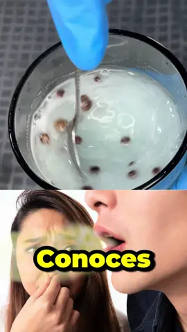 Conoces una persona que siempre tiene un bajo a boca y un mal olor ahí adentro que nunca se le quita, pues envíale este video para que acabe con ese problema. #Recetas #Remedios #RemediosCaseros #RemediosNaturales #MalAliento.