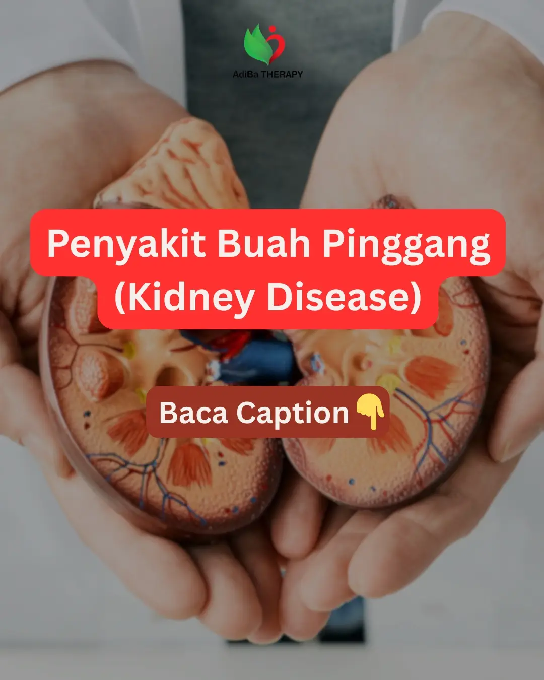✅ Buah Pinggang = Kidney Disease (Penyakit Buah Pinggang) Penyakit buah pinggang berlaku apabila fungsi buah pinggang untuk menapis bahan buangan dan cecair berlebihan daripada darah menjadi lemah atau gagal sepenuhnya. Ia boleh berkembang secara perlahan (kronik) atau berlaku secara tiba-tiba (akut). 🔎 Faktor Utama Kenapa Penyakit Buah Pinggang Berlaku + Penjelasan: 1. Kencing Manis (Diabetes Mellitus) - Paras gula tinggi dalam darah lama-kelamaan merosakkan salur darah halus dalam buah pinggang. - Buah pinggang gagal menapisl bahan buangan dengan baik. 2. Tekanan Darah Tinggi (Hipertensi) - Tekanan darah yang tidak terkawal boleh merosakkan salur darah buah pinggang. - Akibatnya, penapisan darah jadi tidak efisien. 3. Pengambilan Ubat / Bahan Kimia Secara Berlebihan - Penggunaan ubat tahan sakit (NSAIDs), jamu, atau ubat tidak berdaftar boleh merosakkan buah pinggang. 4. Kurang Minum Air Putih - Badan kekurangan air menyebabkan bahan buangan terkumpul dan membebankan buah pinggang. 5. Jangkitan atau Batu Karang - Batu karang yang tersumbat lama boleh rosakkan tisu buah pinggang. - Jangkitan berulang juga boleh melemahkan fungsi buah pinggang. 6. Keturunan / Genetik - Risiko lebih tinggi jika ahli keluarga pernah menghidap penyakit buah pinggang. 7. Merokok & Alkohol Berlebihan - Merosakkan salur darah dan mengganggu fungsi penapisan buah pinggang. ✅ Wajib Buat untuk Kawal Kesihatan Buah Pinggang: 1. Periksa fungsi buah pinggang secara berkala (ujian darah & air kencing). 2. Kawal tekanan darah dan paras gula. 3. Minum air kosong secukupnya (2–3L sehari, ikut nasihat doktor). 4. Kurangkan garam & makanan tinggi protein haiwan berlebihan. 5. Amalkan diet seimbang rendah natrium, fosforus, dan kalium. 6. Elak ubat tanpa nasihat doktor. 7. Berhenti merokok & hadkan pengambilan alkohol. 8. Bersenam secara sederhana dan kawal berat badan. ❌ Pantang Keras (Perlu Elak): 1. Makanan tinggi garam (ikan masin, kicap, makanan proses). 2. Daging merah & organ dalaman secara berlebihan. 3. Makanan segera, mi segera, makanan dalam tin. 4. Minuman bergas, teh tarik, kopi pekat. 5. Ubat / jamu tidak berdaftar. 6. Alkohol & rokok. 🍽️ Makanan Sesuai untuk Pesakit Buah Pinggang (ikut tahap penyakit): 1. Karbohidrat Kompleks: Nasi putih, ubi keledek, roti tanpa garam. 2. Sayur-sayuran Rendah Kalium: Kubis, timun, sawi, lobak putih. 3. Buah-buahan Rendah Kalium: Epal, jambu batu, anggur, nenas. 4. Protein Terhad & Berkualiti: Ikan putih, ayam tanpa kulit, telur (1 biji/hari). 5. Lemak Sihat: Minyak zaitun, minyak kanola. 6. Minuman Sesuai: Air kosong, air barli tanpa gula (ikut nasihat doktor). 🌿 Makanan Sunnah / Superfood untuk Sokong Kesihatan Buah Pinggang: 1. Minyak Zaitun Extra Virgin: Kurangkan keradangan & tekanan darah. 2. Habbatus Sauda (Jintan Hitam): Bersifat antioksidan & bantu lindungi sel buah pinggang. 3. Buah Delima: Kaya antioksidan – bantu lindungi tisu buah pinggang. 4. Barli (Jau): Bantu kurangkan kolesterol & tekanan darah. 5. Kurma (secara terkawal): Sumber tenaga semula jadi; elak berlebihan. 6. Madu Asli (secara terkawal): Antioksidan semula jadi; gantian gula sihat. 7. Kacang Badam dan Walnut (dalam jumlah kecil): Lemak sihat & anti-radang. 8. Cuka Epal: Boleh bantu kurangkan tekanan darah & gula (dengan nasihat doktor). ⚠️ Komplikasi Jika Tidak Kawal Penyakit Buah Pinggang: 1. Gagal Buah Pinggang Kronik (perlu dialisis). 2. Tekanan darah tinggi berterusan. 3. Masalah jantung & strok. 4. Bengkak pada kaki dan muka. 5. Kelesuan melampau & kurang selera makan. 6. Anemia (kurang darah merah). 7. Tulang rapuh & lemah. 8. Risiko kematian akibat kegagalan organ. #AdibaTherapy #UstazahBadariah 