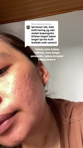 Membalas @khocol_ #bopengbekasjerawat #acneproneskin #bopeng #bopengjerawat #bekasjerawat 