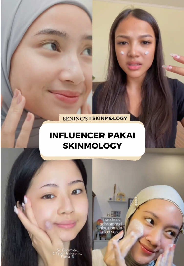 Anselma, arthada dan banyak lainnya aja pakai skinmology kamu kapan?😍 #skinmology #lockyourbright #skinmologybybeningsindonesia 