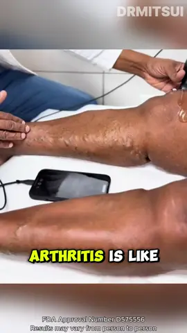 💥 Joint pain? This patch STOPS it in one move! 🔥#joint #PainPatch #HealthyLiving #unitedstates #DRMITSUI -ZL