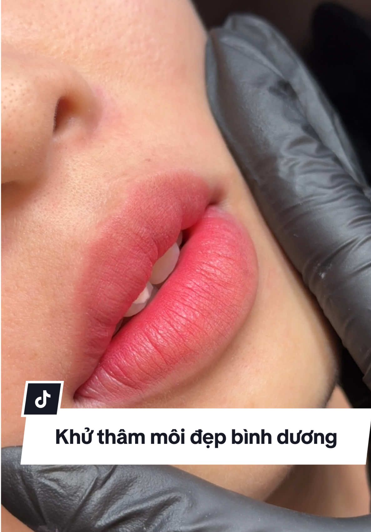 Nền môi mới xử lý xong không hề có cặn mực . Em quay bằng cam thường cho mọi người tham khảo ạ 🥰🥰🥰#genz #phunxamkimnga #phunmoidepthuduc #phunmoidepdian #reviewmoidepbinhduong 